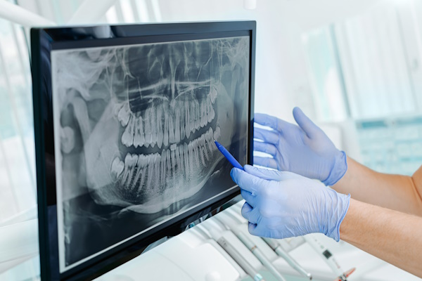 Hands doctor dentist in gloves show the teeth on x-ray on digita