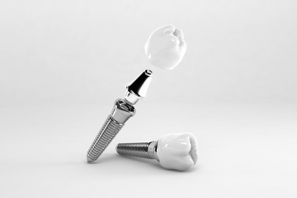 Detail of a false tooth implant fixed